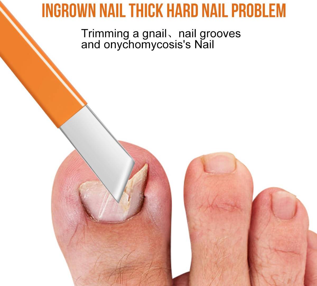 Shein Foot Pedicure Knife